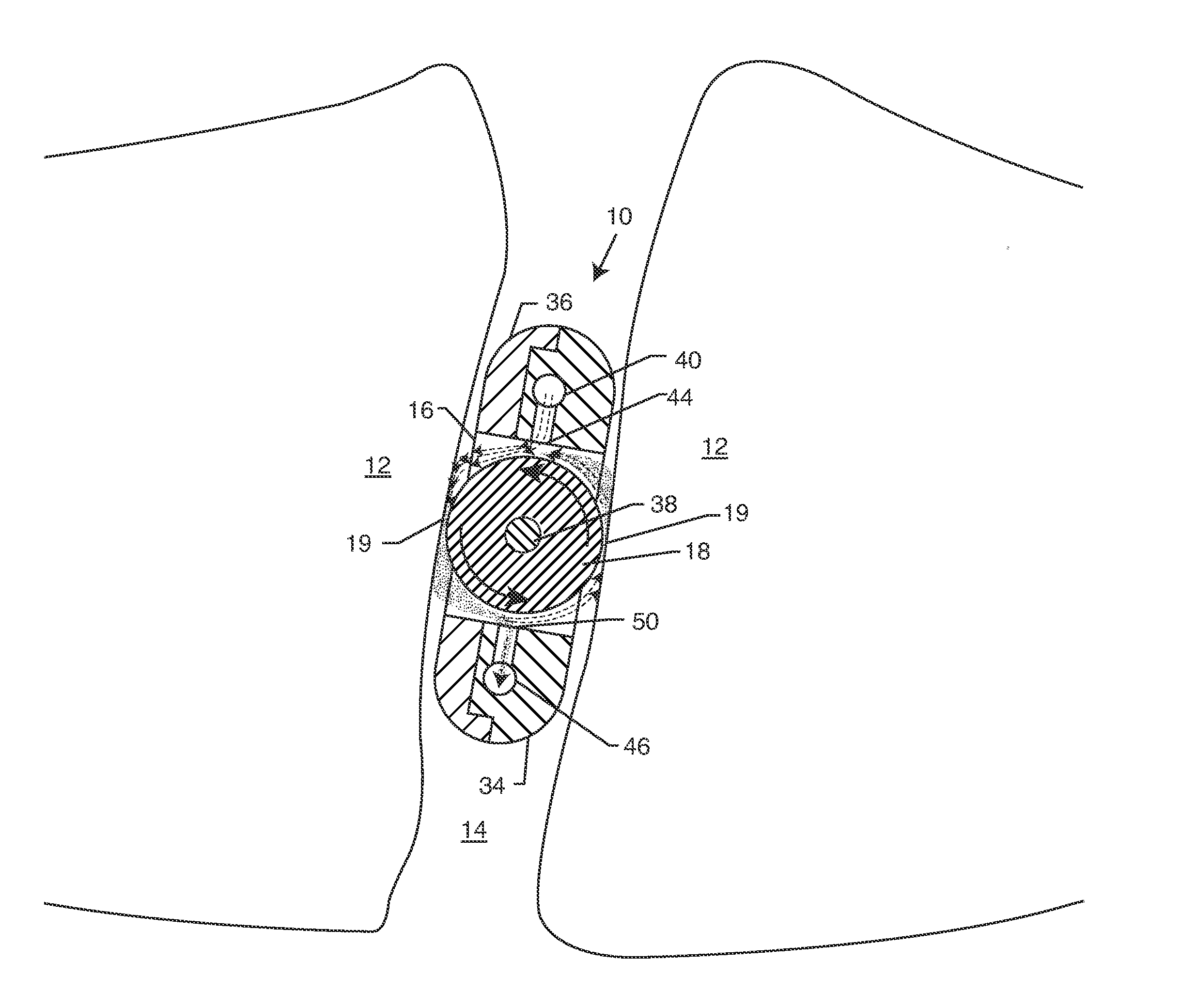 Intervertebral milling instrument