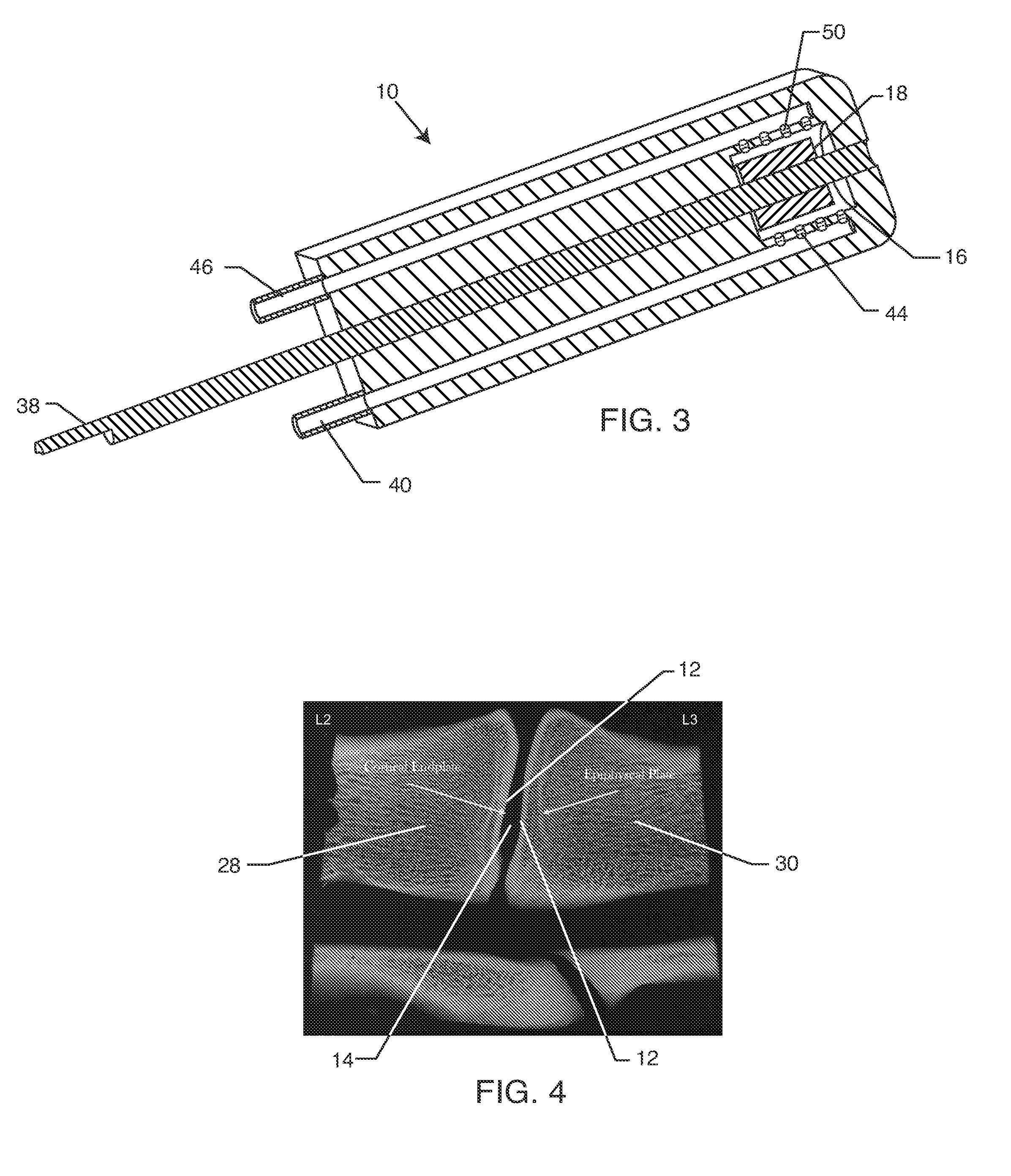 Intervertebral milling instrument