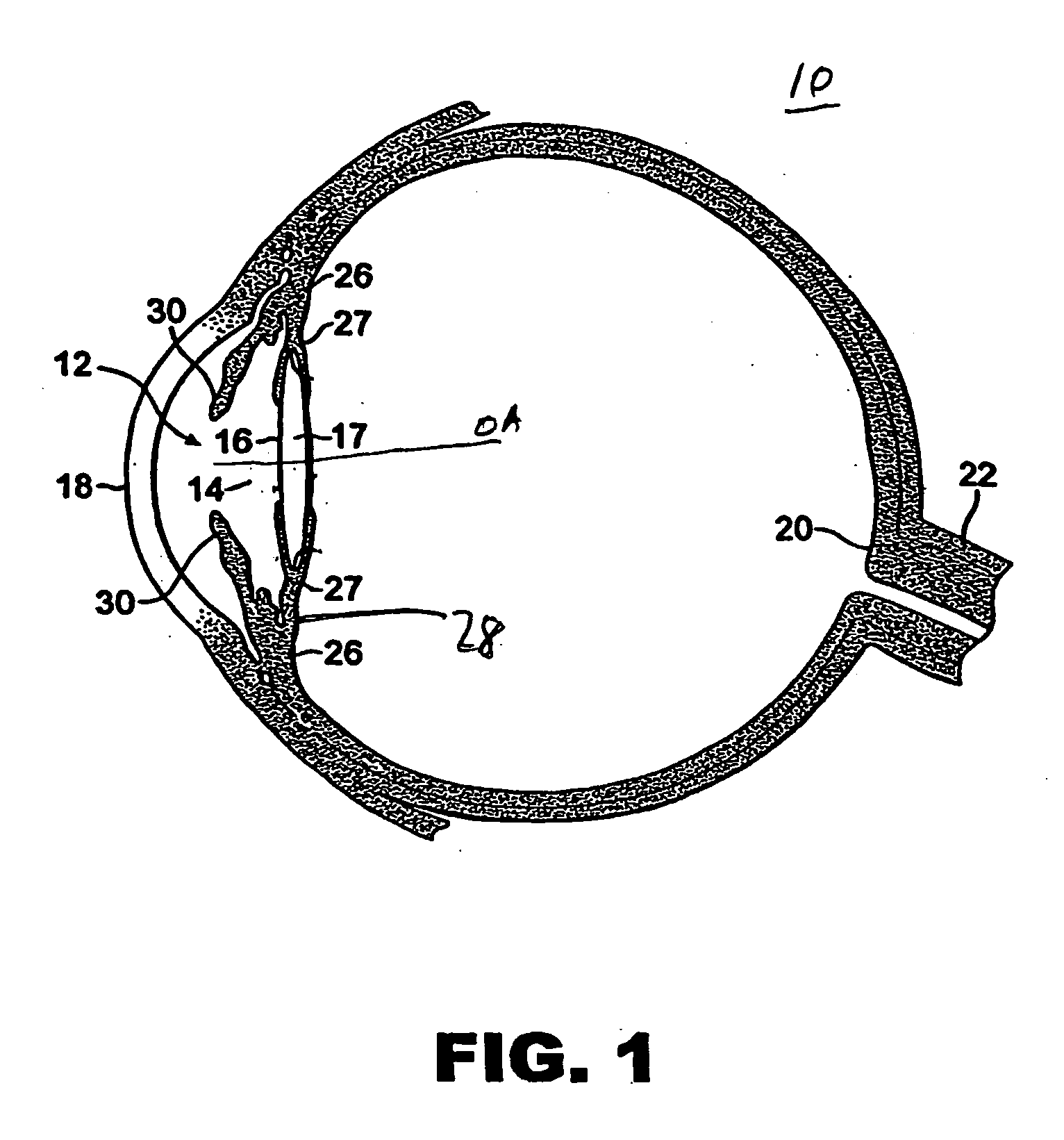 Accommodative intraocular lens