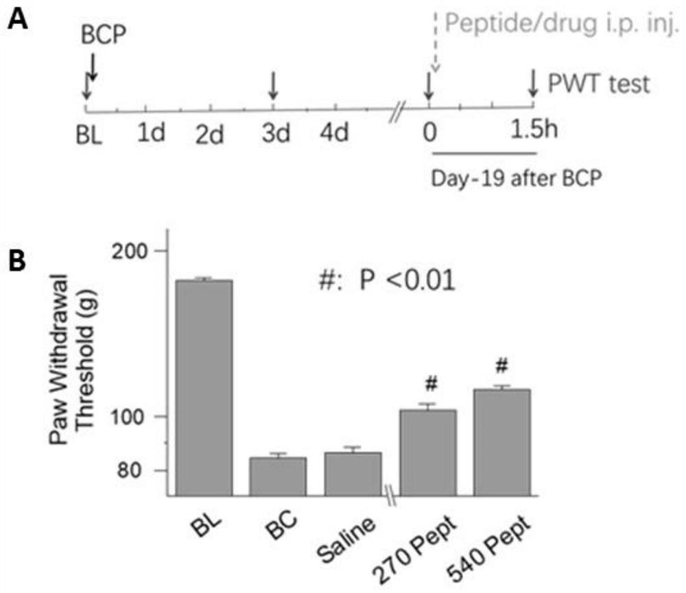 Polypeptide P10581 and application thereof in preparation of medicine for relieving bone cancer pain