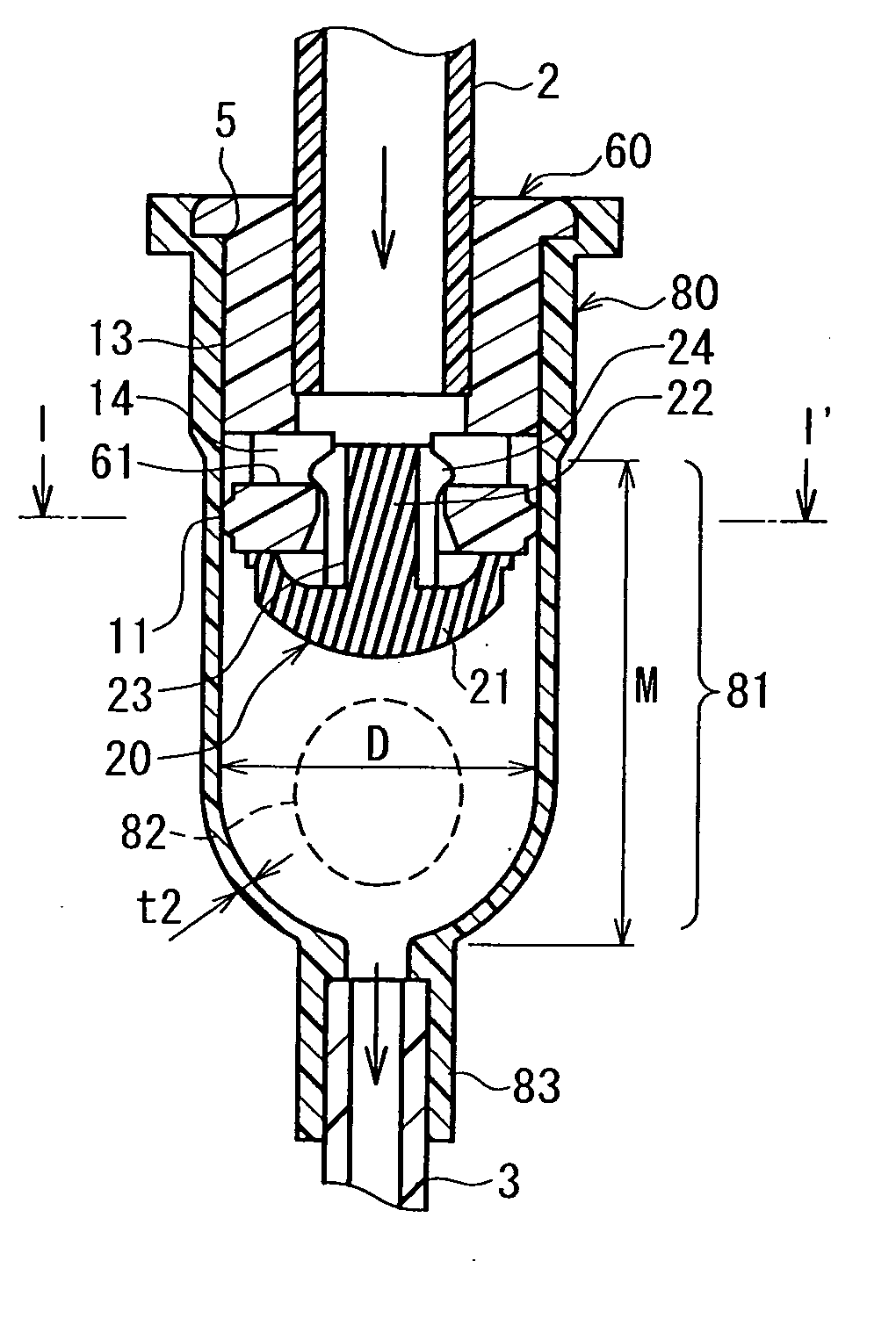 Flow Control Apparatus And Medical Injection Circuit Using The Same