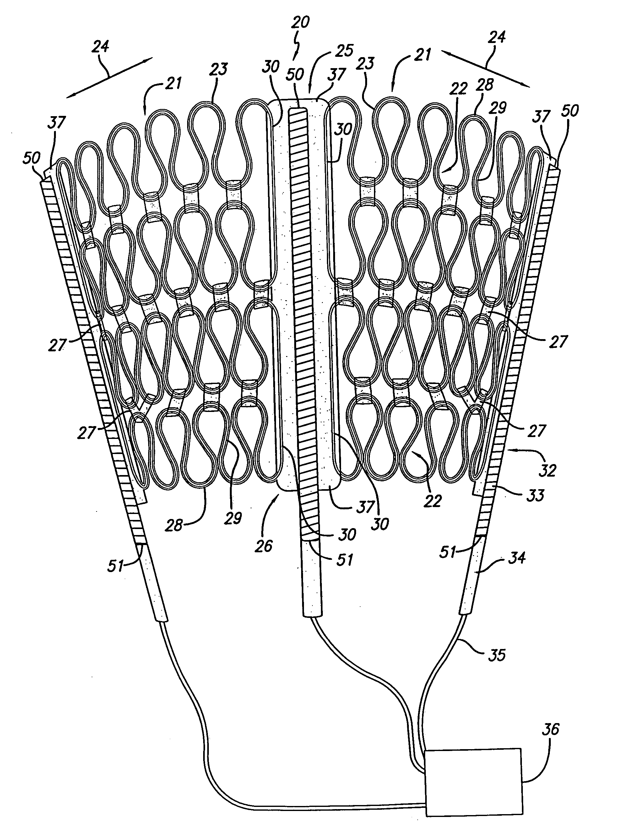 Cardiac harness for treating congestive heart failure and for defibrillating and/or pacing/sensing