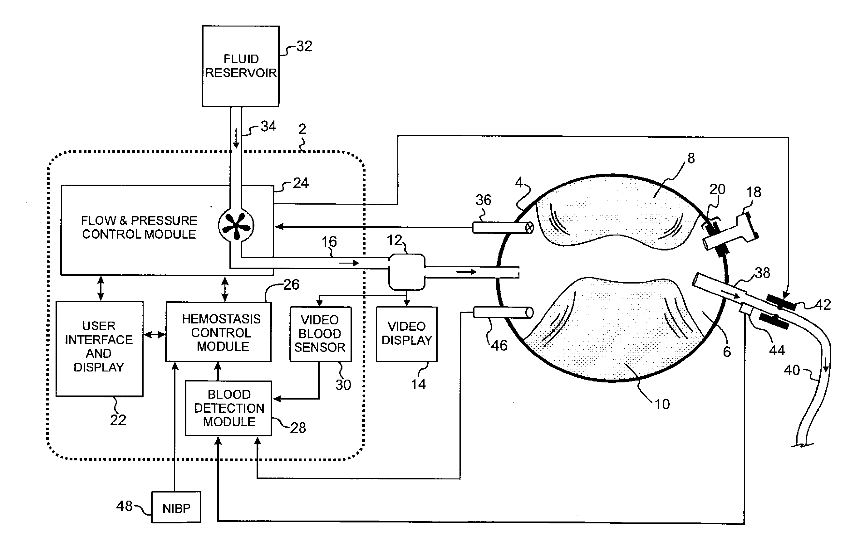 Internal tourniquet for surgery