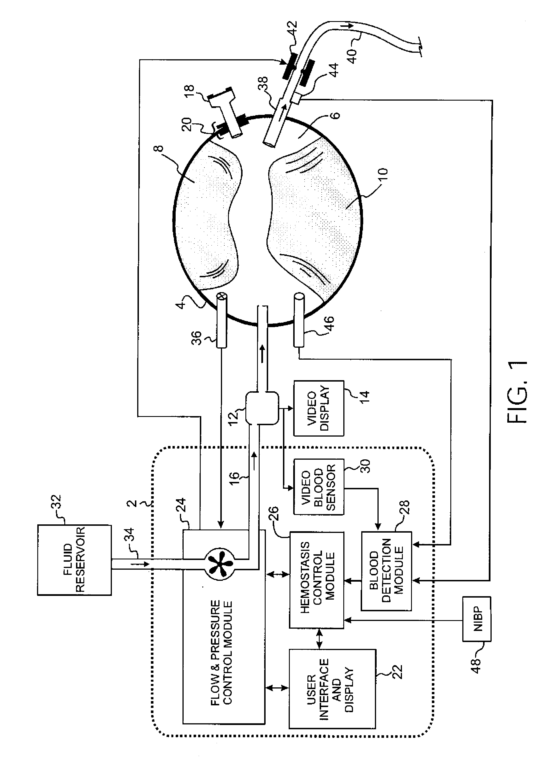 Internal tourniquet for surgery