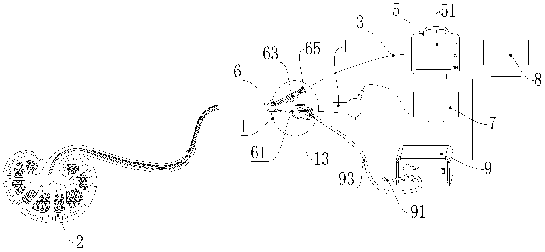 Endoluminal surgery pressure monitoring system, adjusting system and method