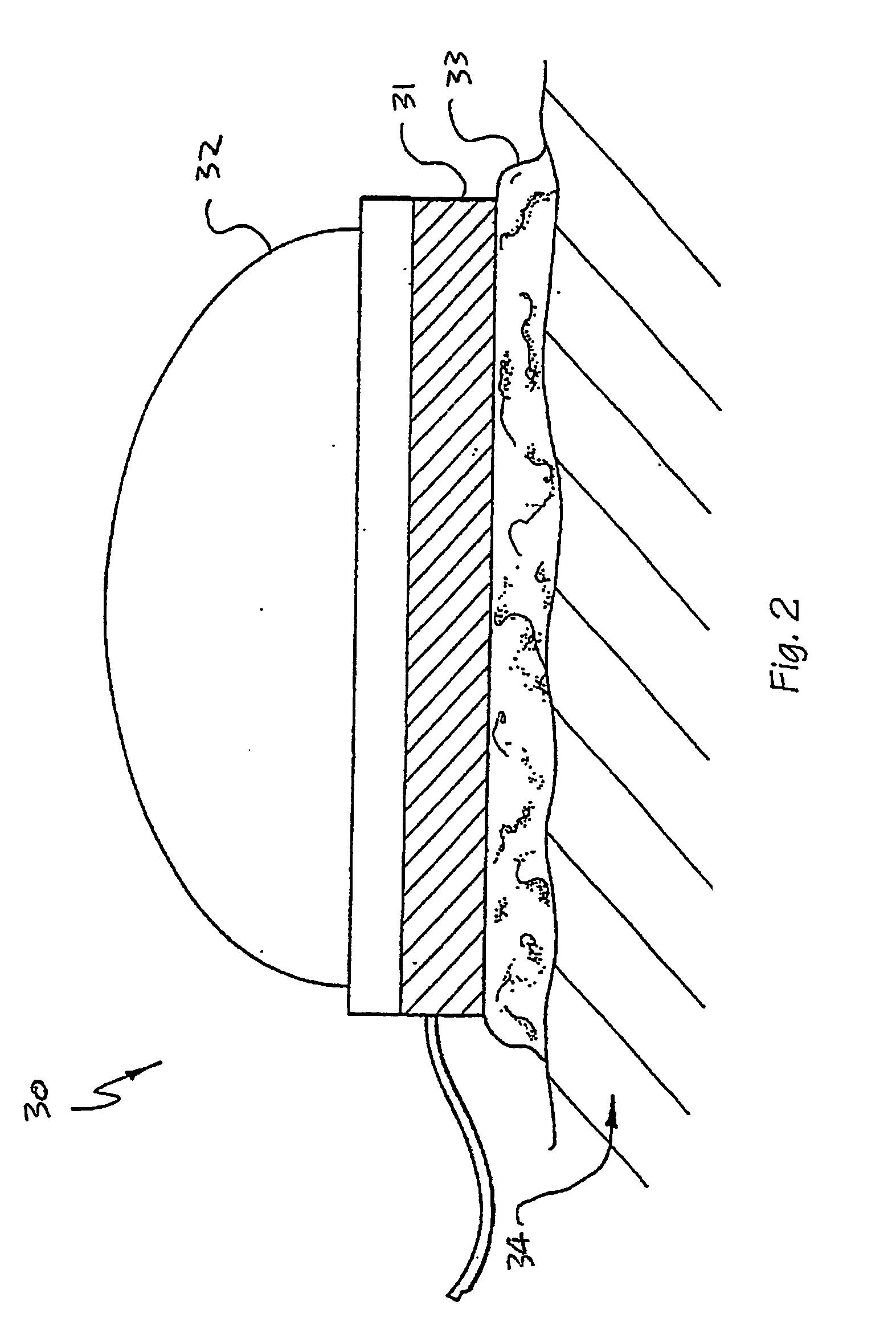 Blood flow oxygen measurement system and method