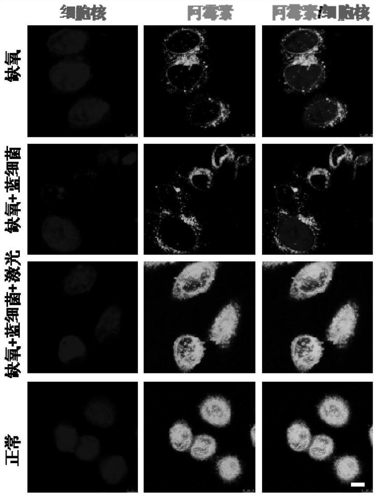 A way to overcome tumor drug resistance