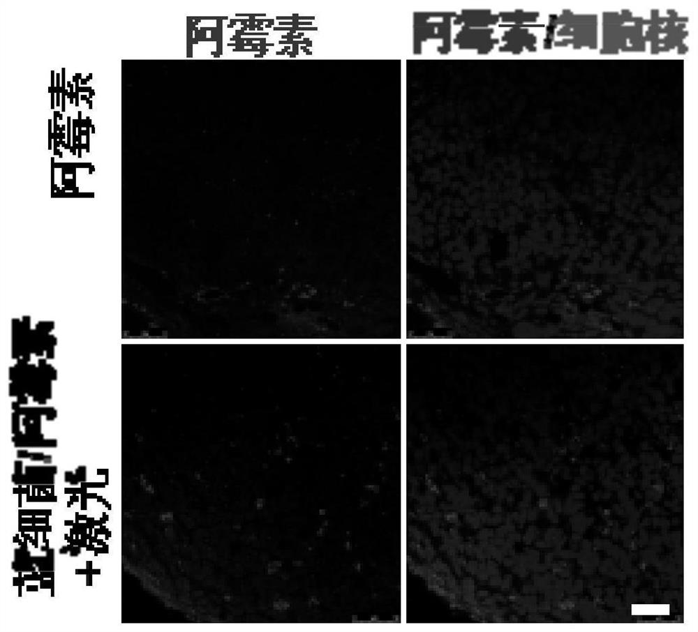 A way to overcome tumor drug resistance