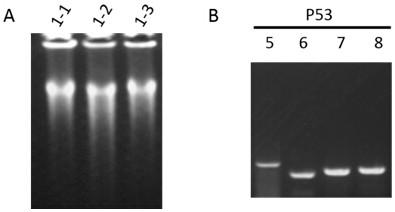 Primer combination and its application for detecting p53 gene mutation in trace tissue