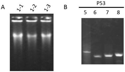 Primer combination and its application for detecting p53 gene mutation in trace tissue