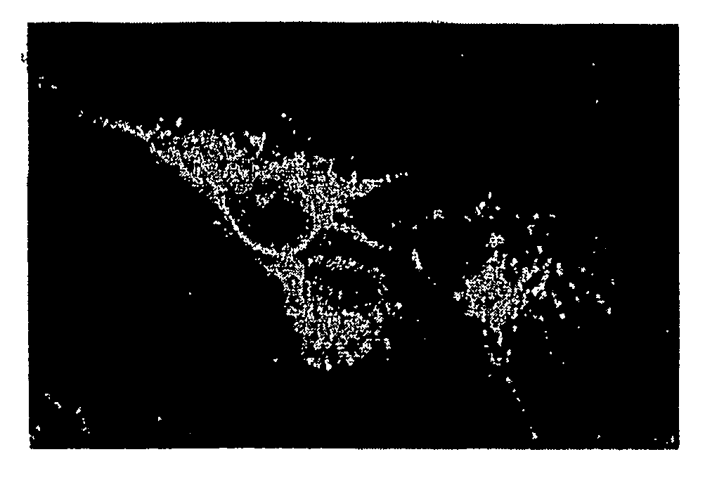 Npc1l1 and npc1l1 inhibitors and methods of use thereof