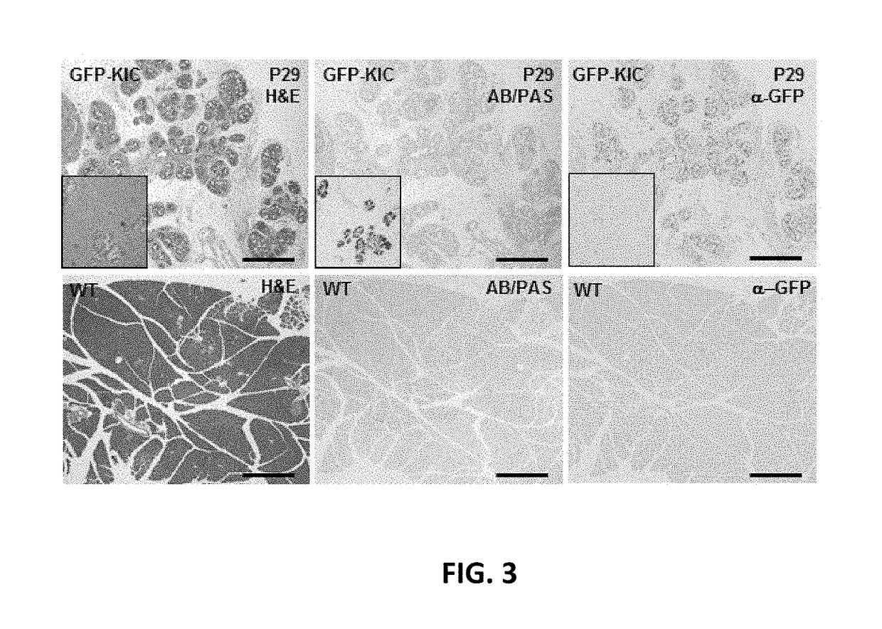 Screen and use of therapeutics for pancreatic ductal adenocarcinoma