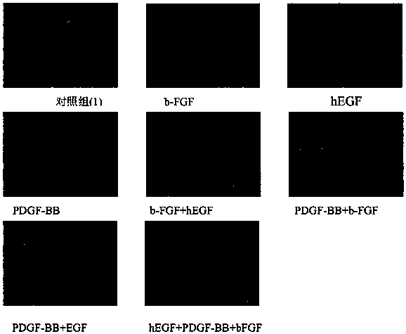 Porcine mesenchymal stem cell culture solution and preparation method thereof