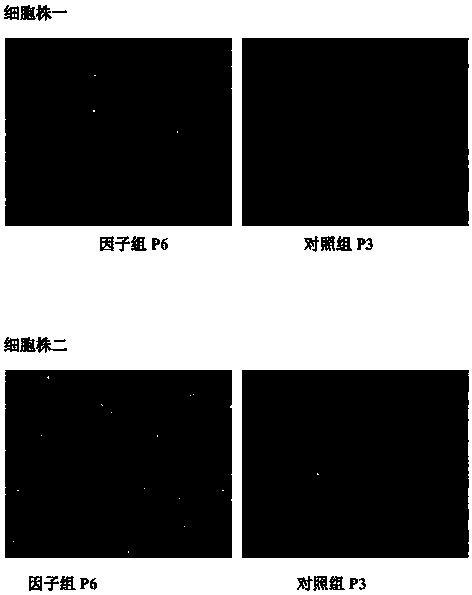 Porcine mesenchymal stem cell culture solution and preparation method thereof