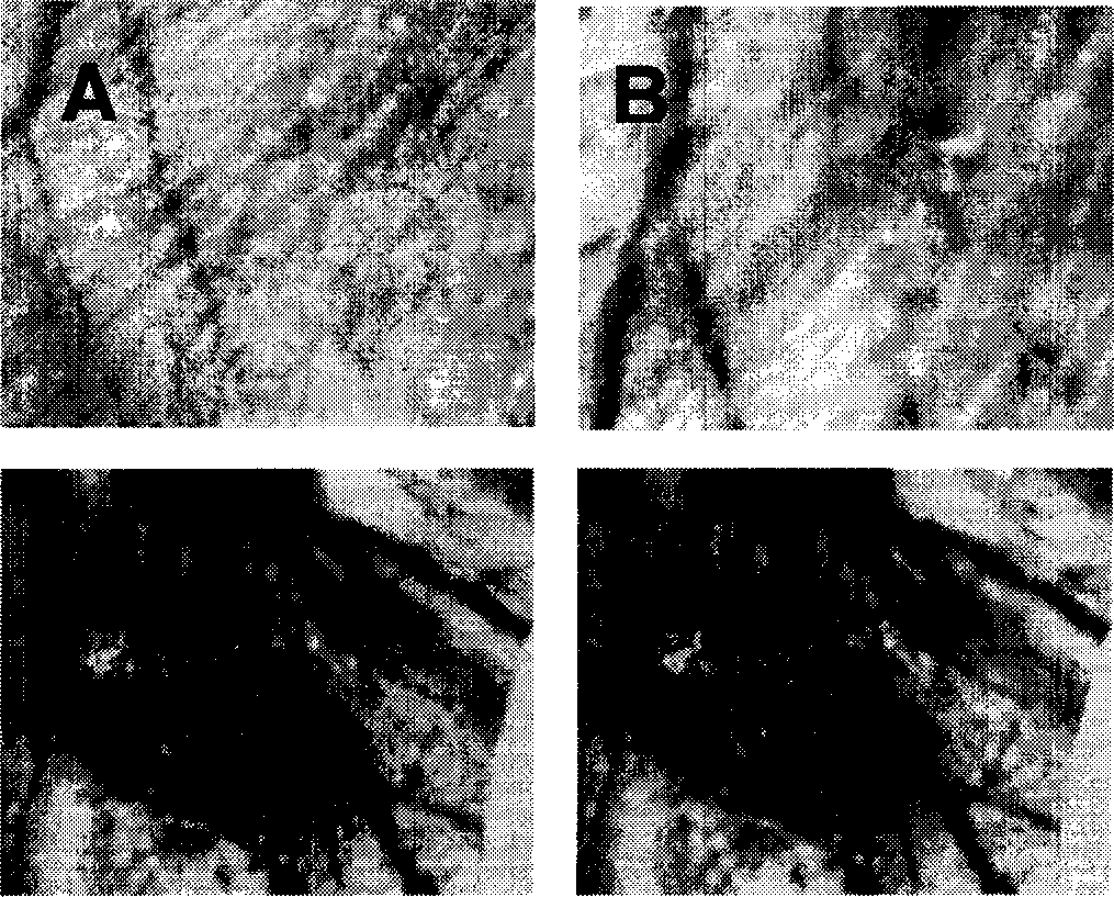 Human angioma rat animal model and its configuration method