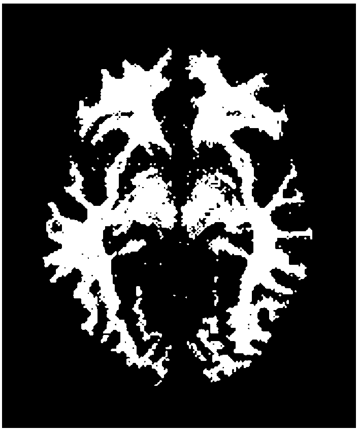 Fuzzy clustering-based brain MR image segmentation method