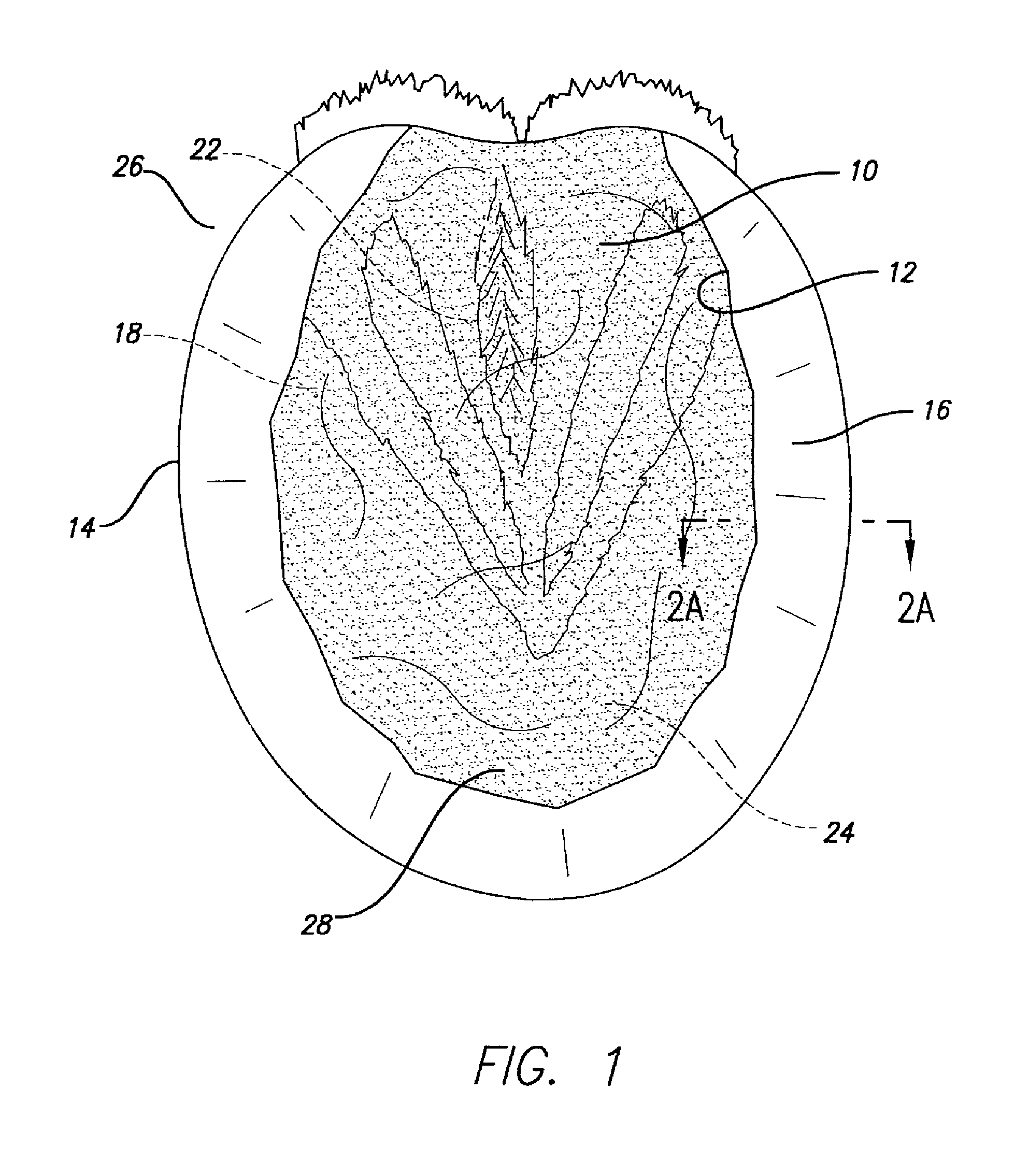 All-in-one packing, pad and shoe for hoof protection