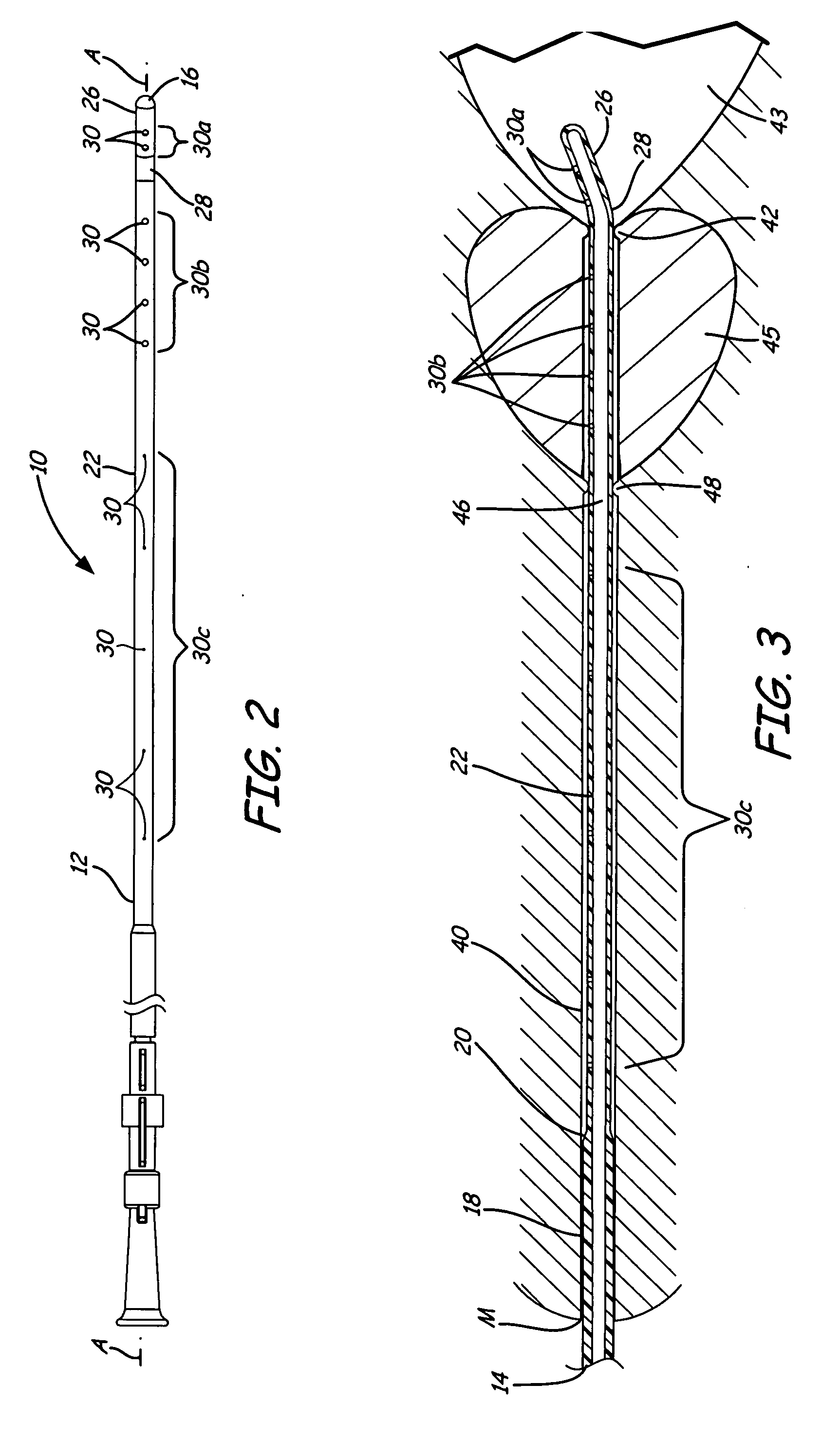 Drainage/irrigation urethral catheter