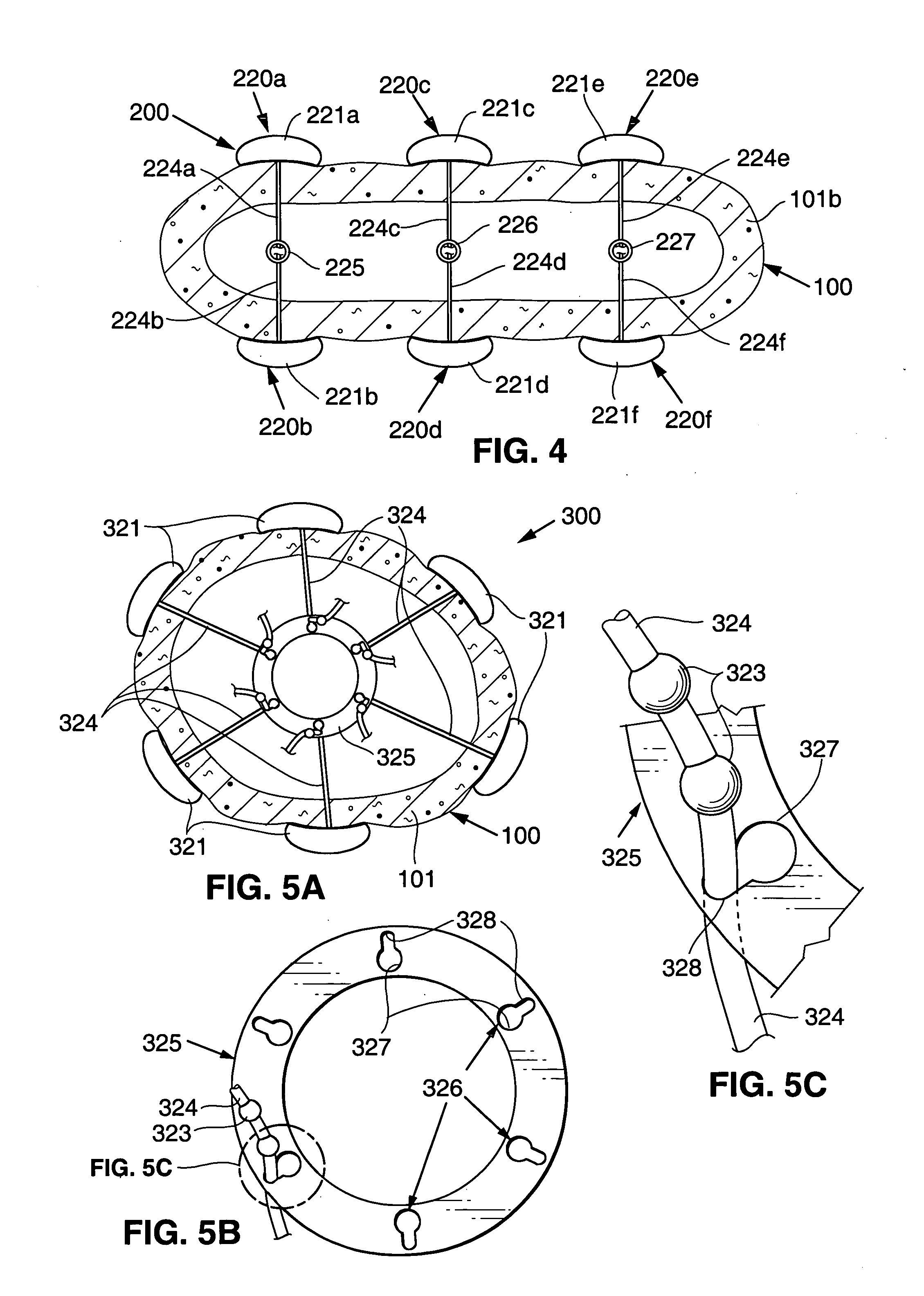 Endoscopic gastric constriction device