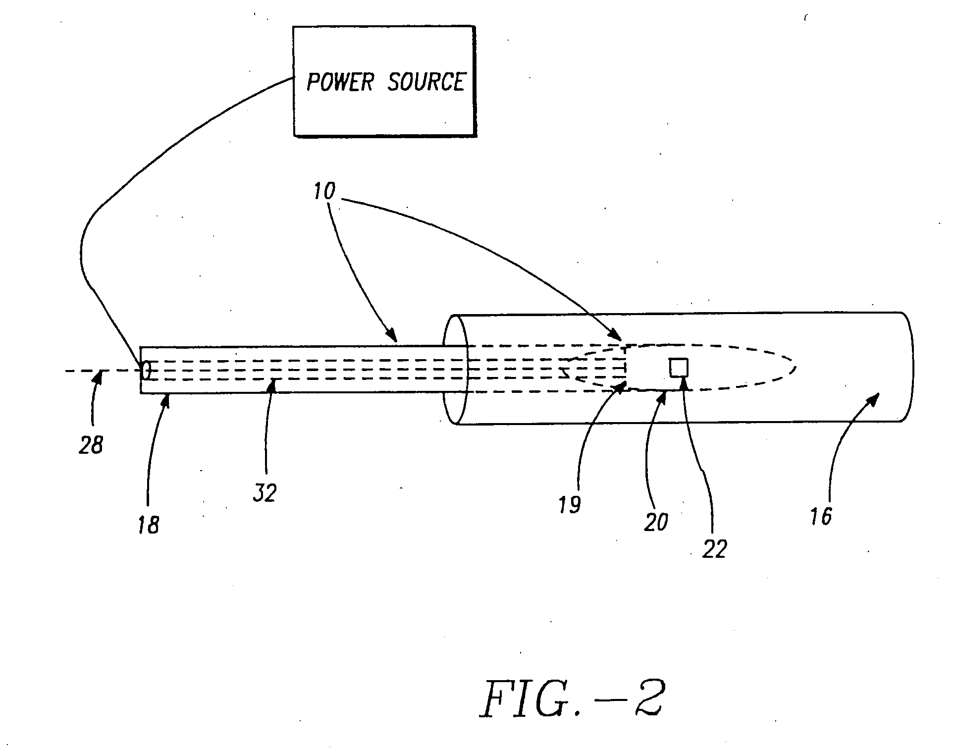 Apparatus to treat esophageal sphincters