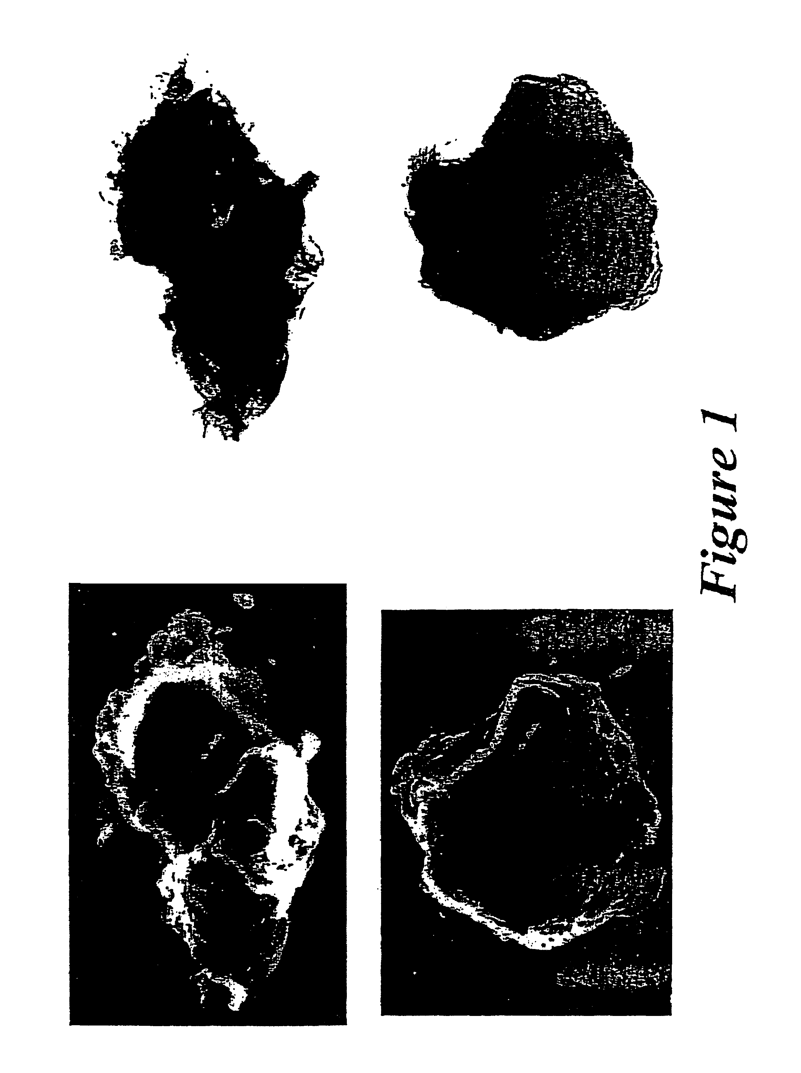 Hydrotalcites, syntheses, and uses