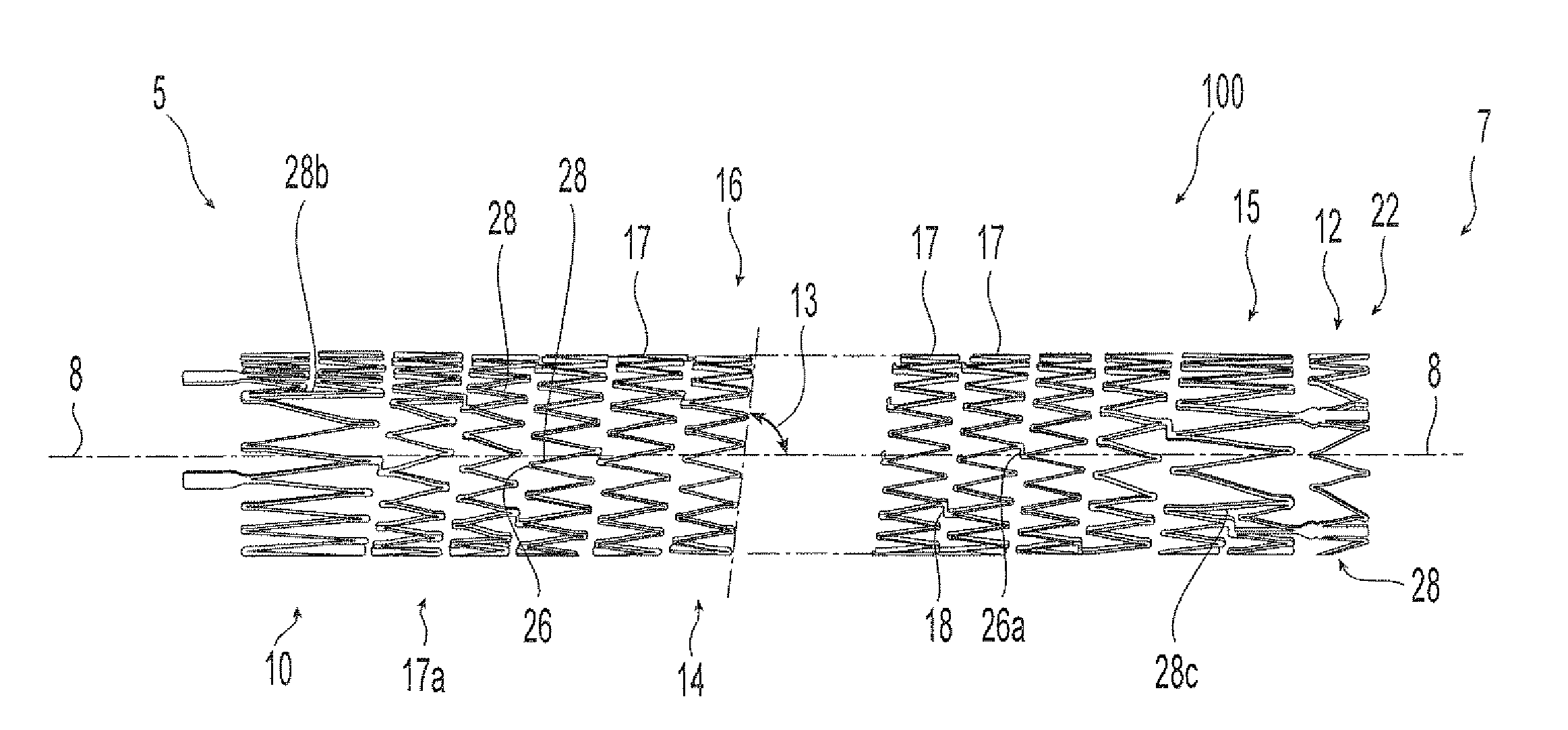 Helical implant having different ends