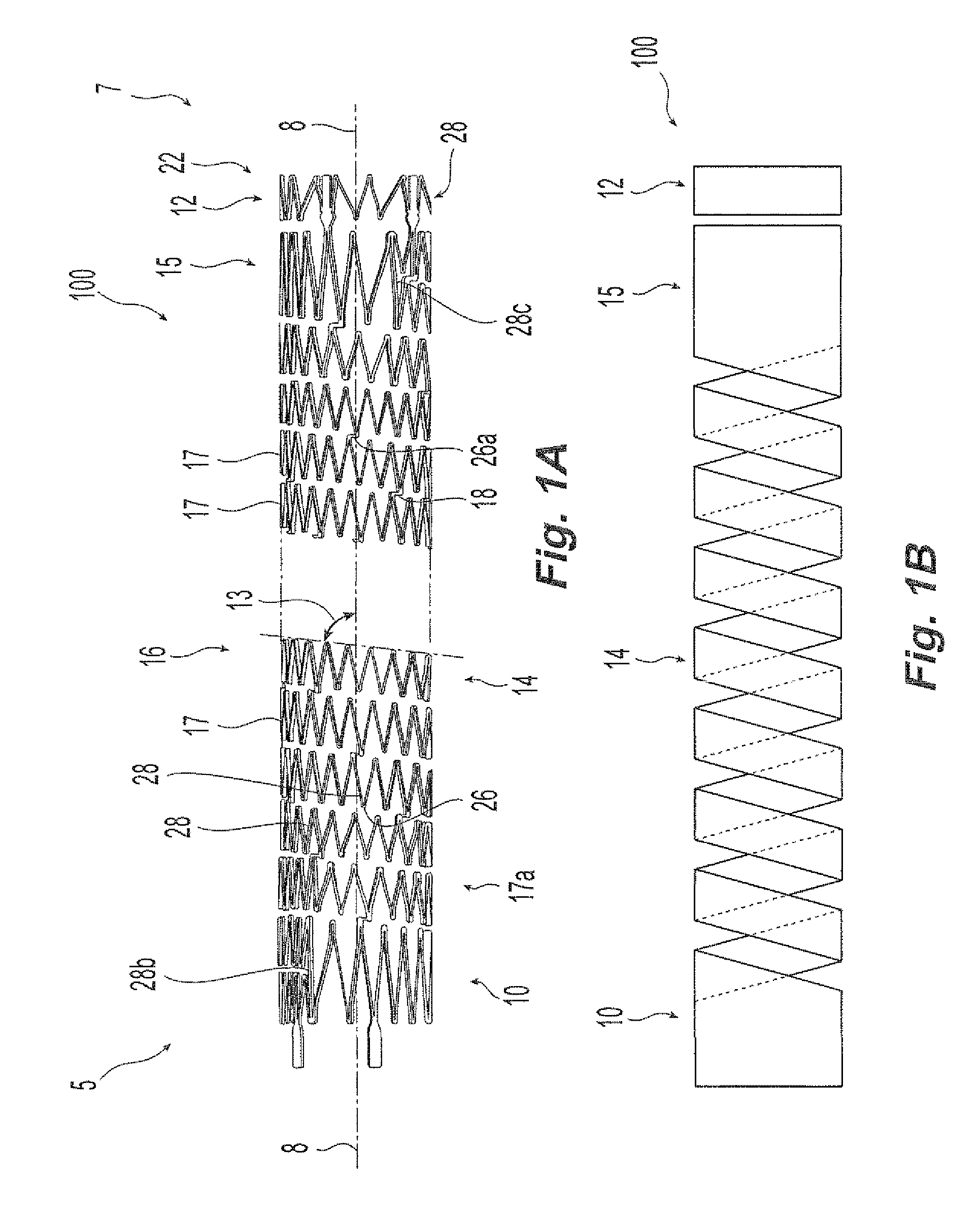 Helical implant having different ends