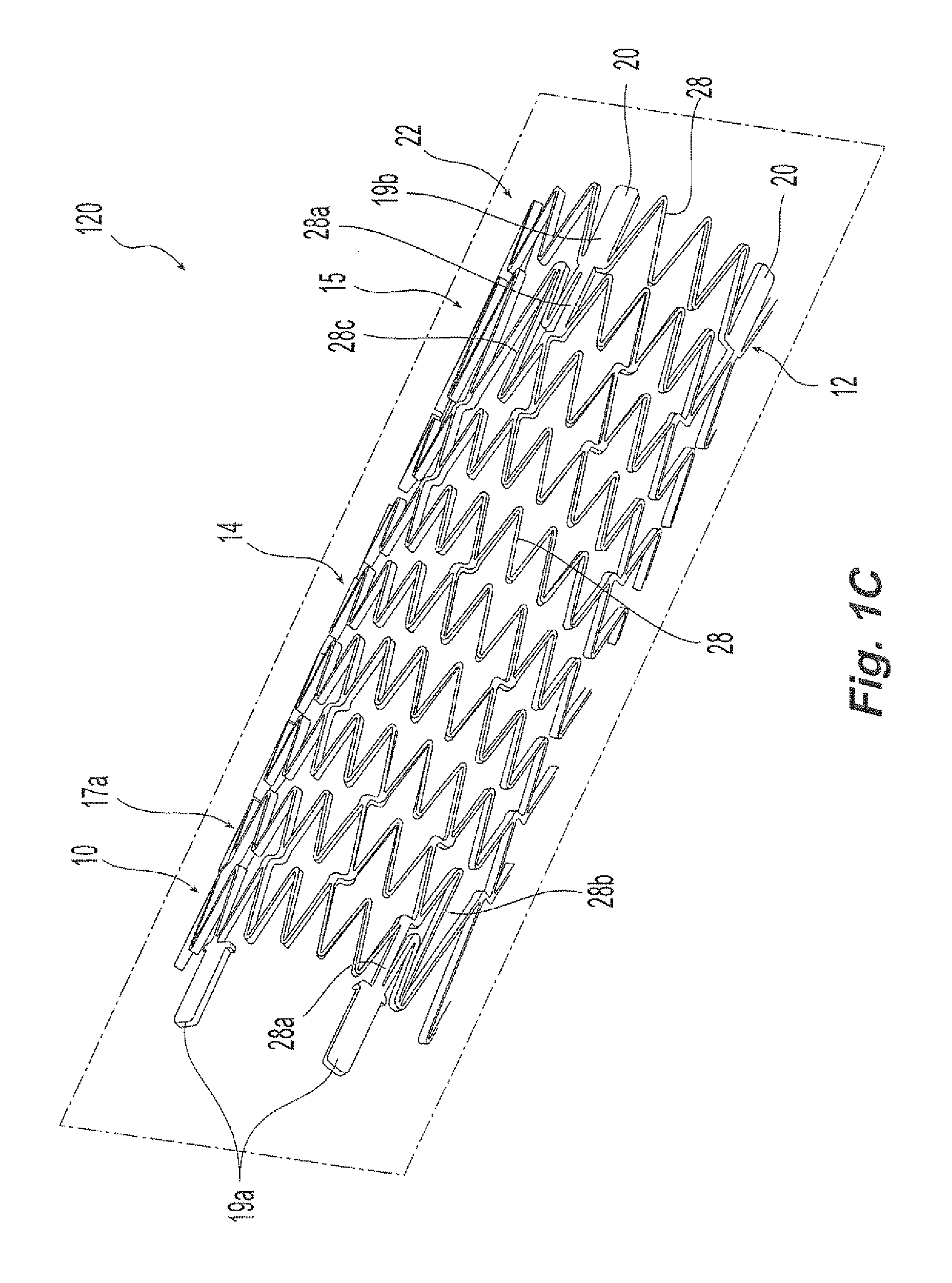 Helical implant having different ends