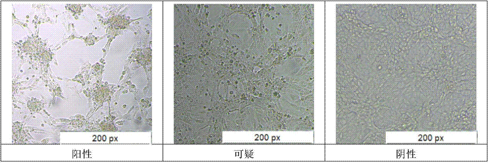 Method for detecting toxigenic pasteurellamultocida toxin formaldehyde inactivated efficacy by using Vero cells (African Green Monkey Kidney cells)