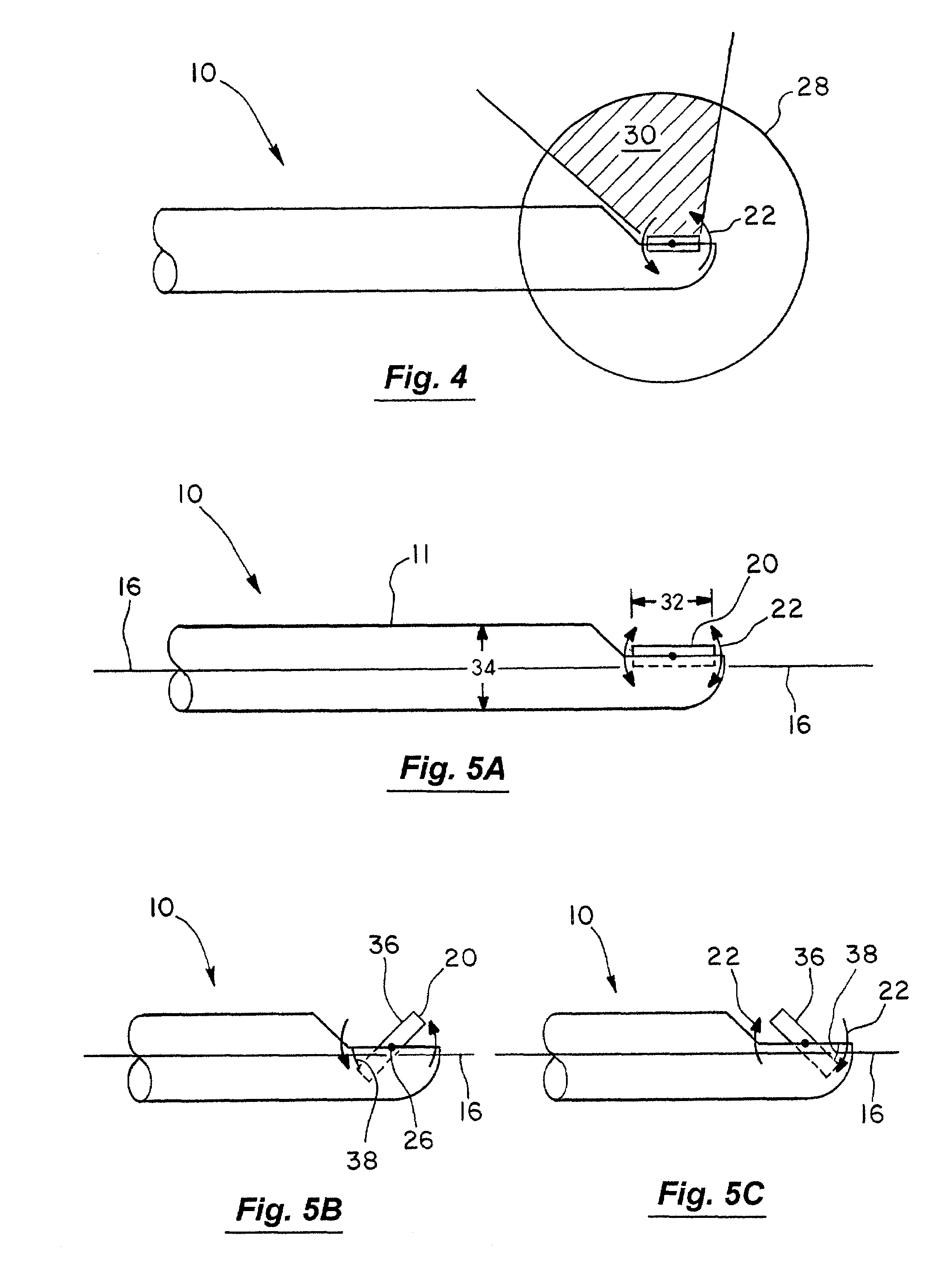 Imaging catheter and methods of use for ultrasound-guided ablation