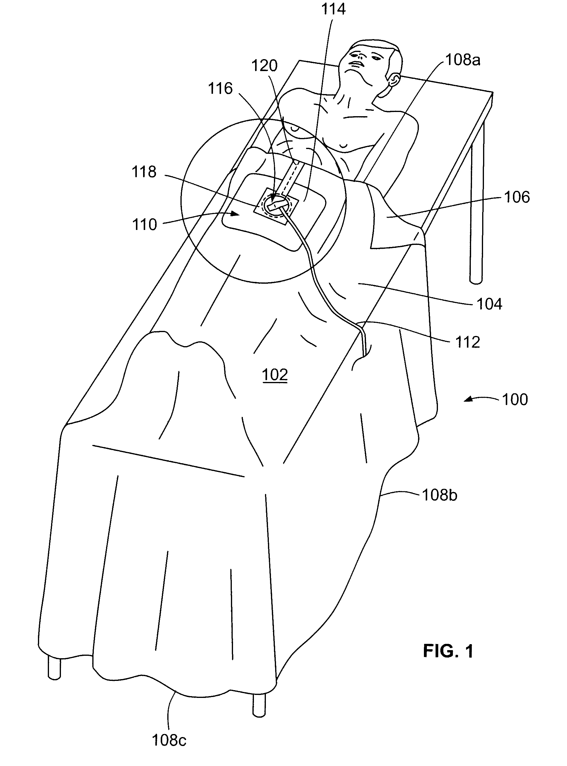 Zip strip draping system and methods of manufacturing same