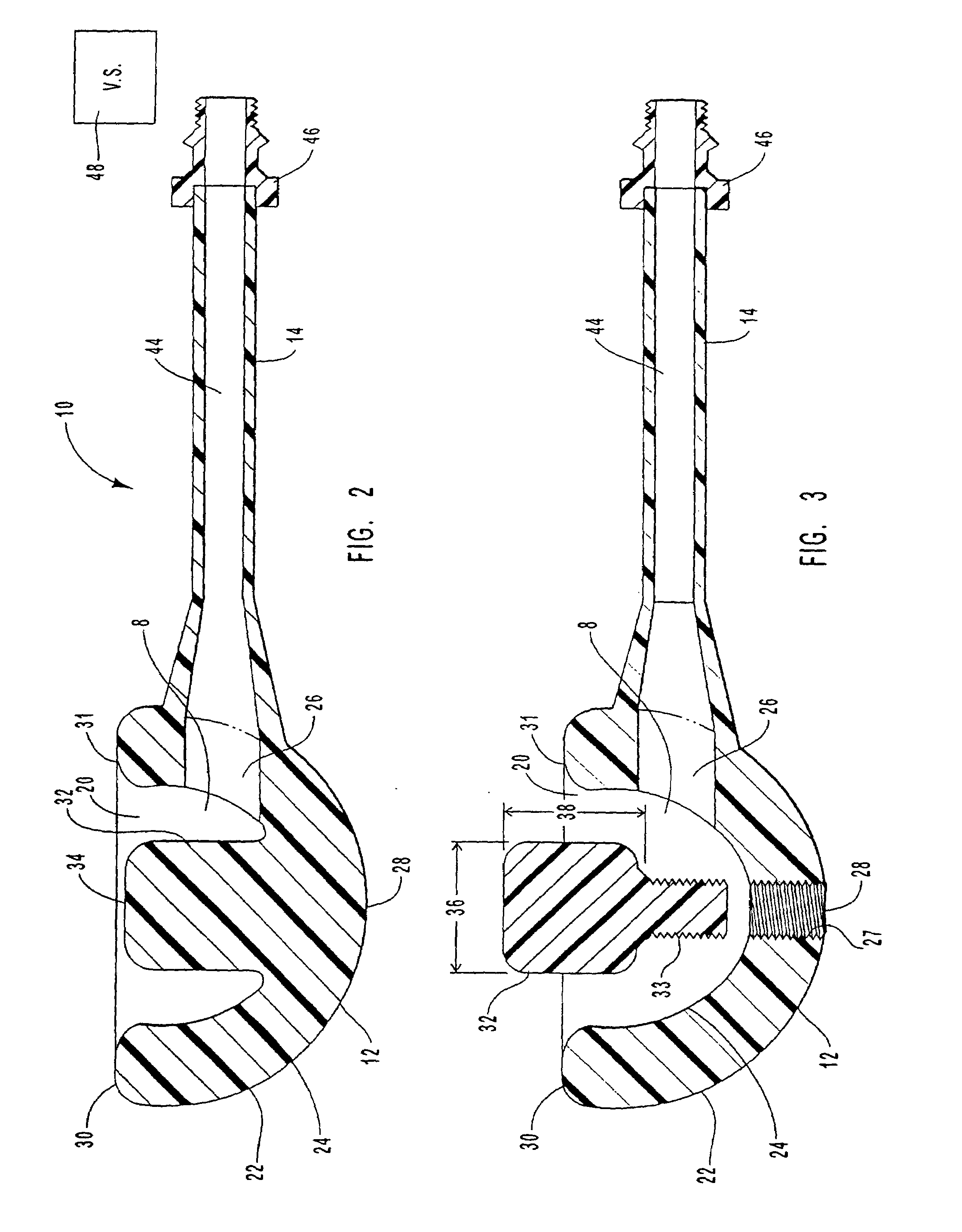 Method and system for performing microabrasion and suction massage