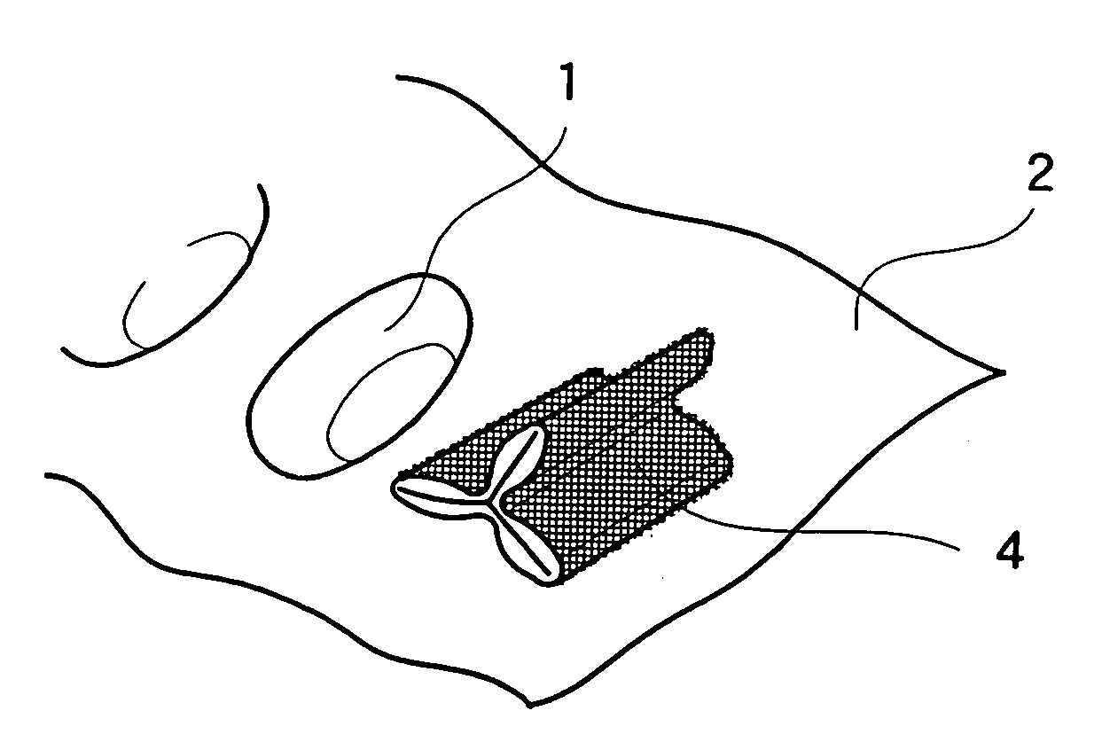 Mechanical heart valve and production method thereof