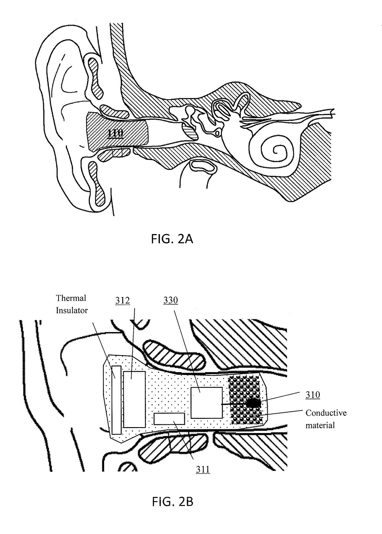 System for body temperature measurement