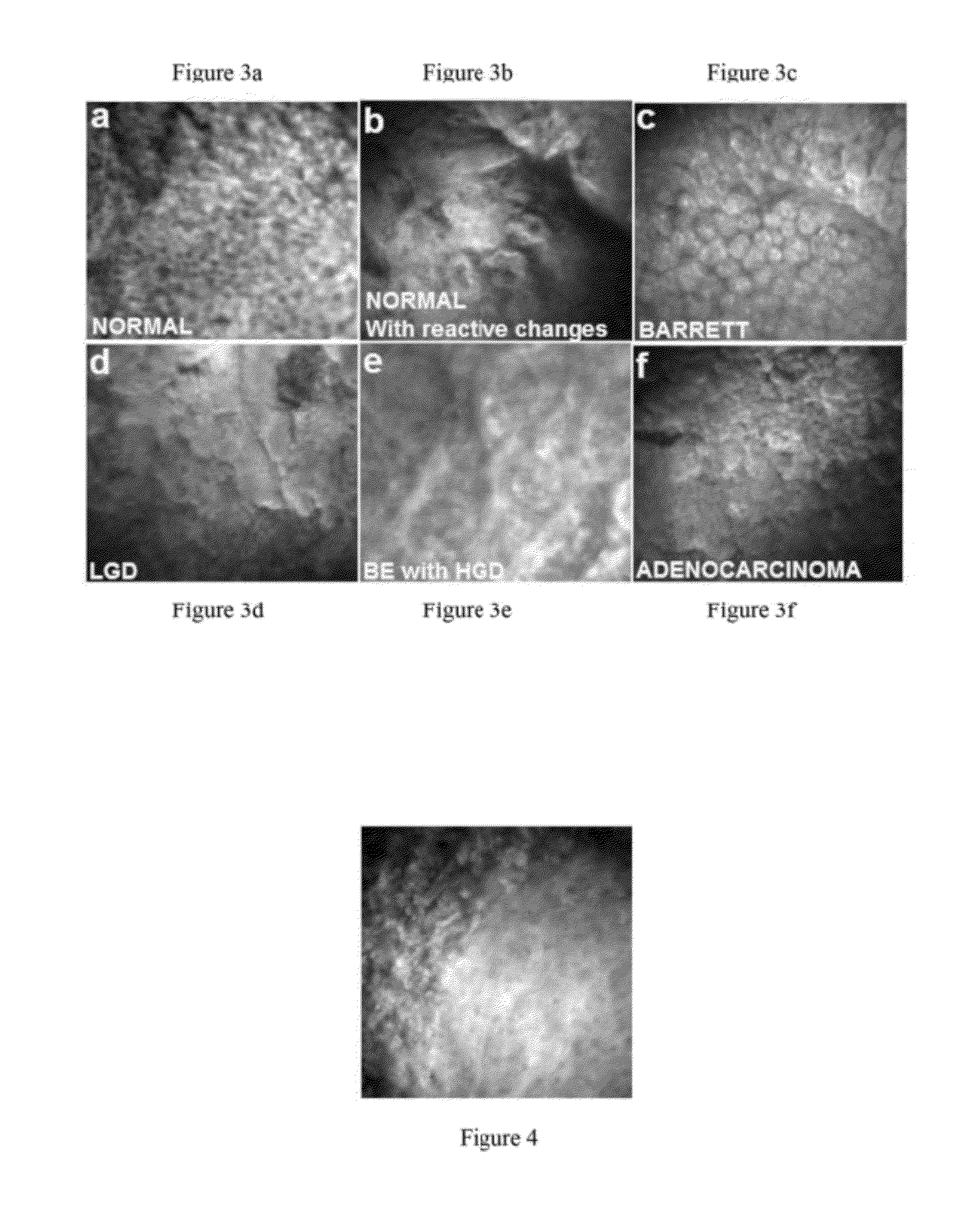 In vivo spectral micro-imaging of tissue