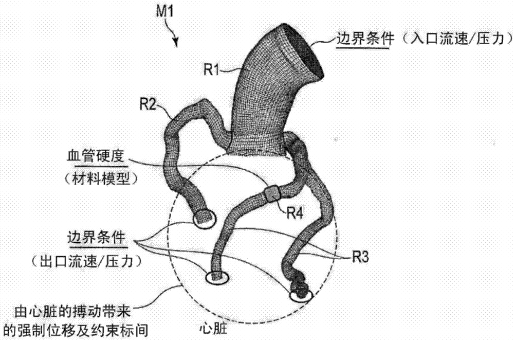 Blood vessel analysis device, medical image diagnostic device, and blood vessel analysis method