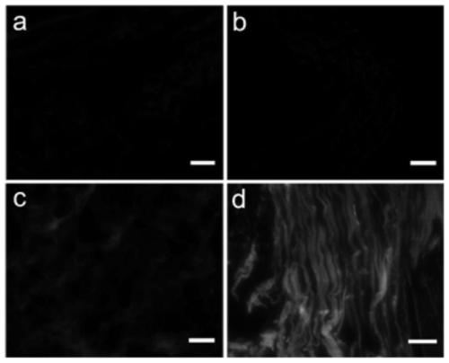 Polypeptide probe for targeted recognition of denatured collagen and detection method thereof