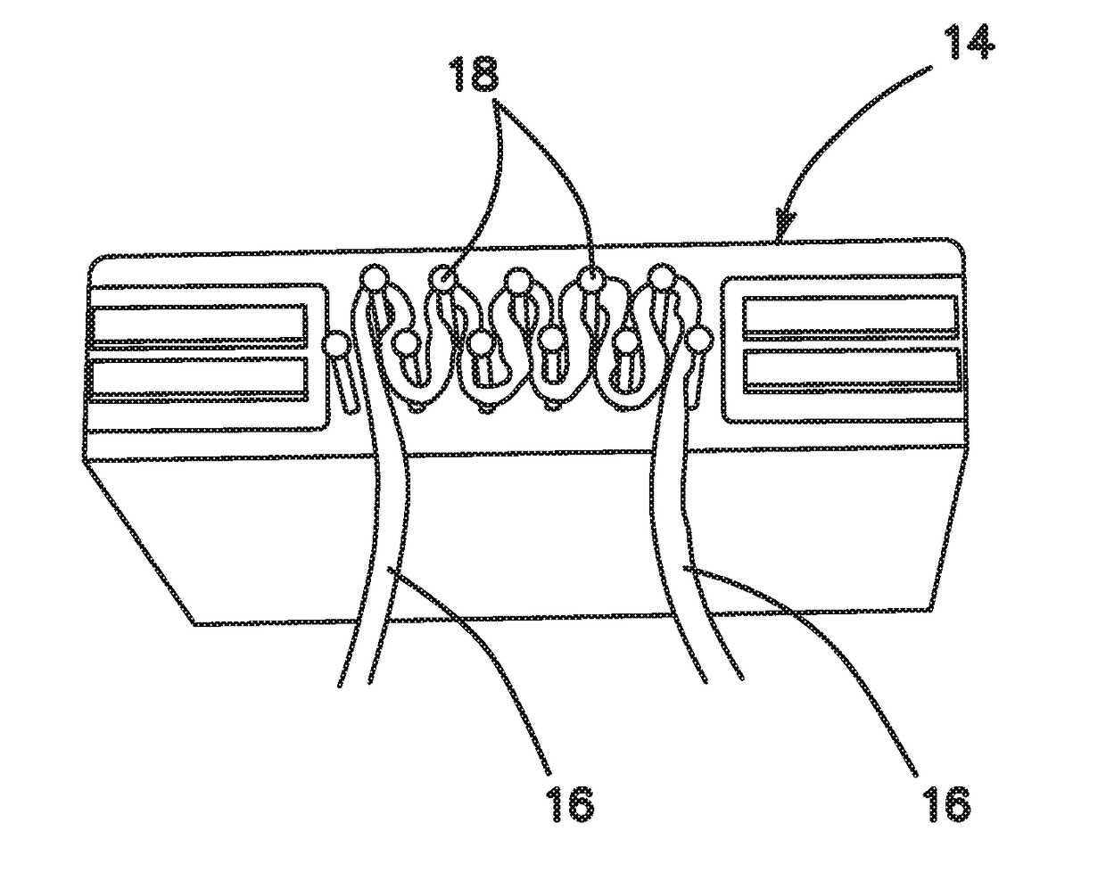 All-suture suture anchor systems and methods