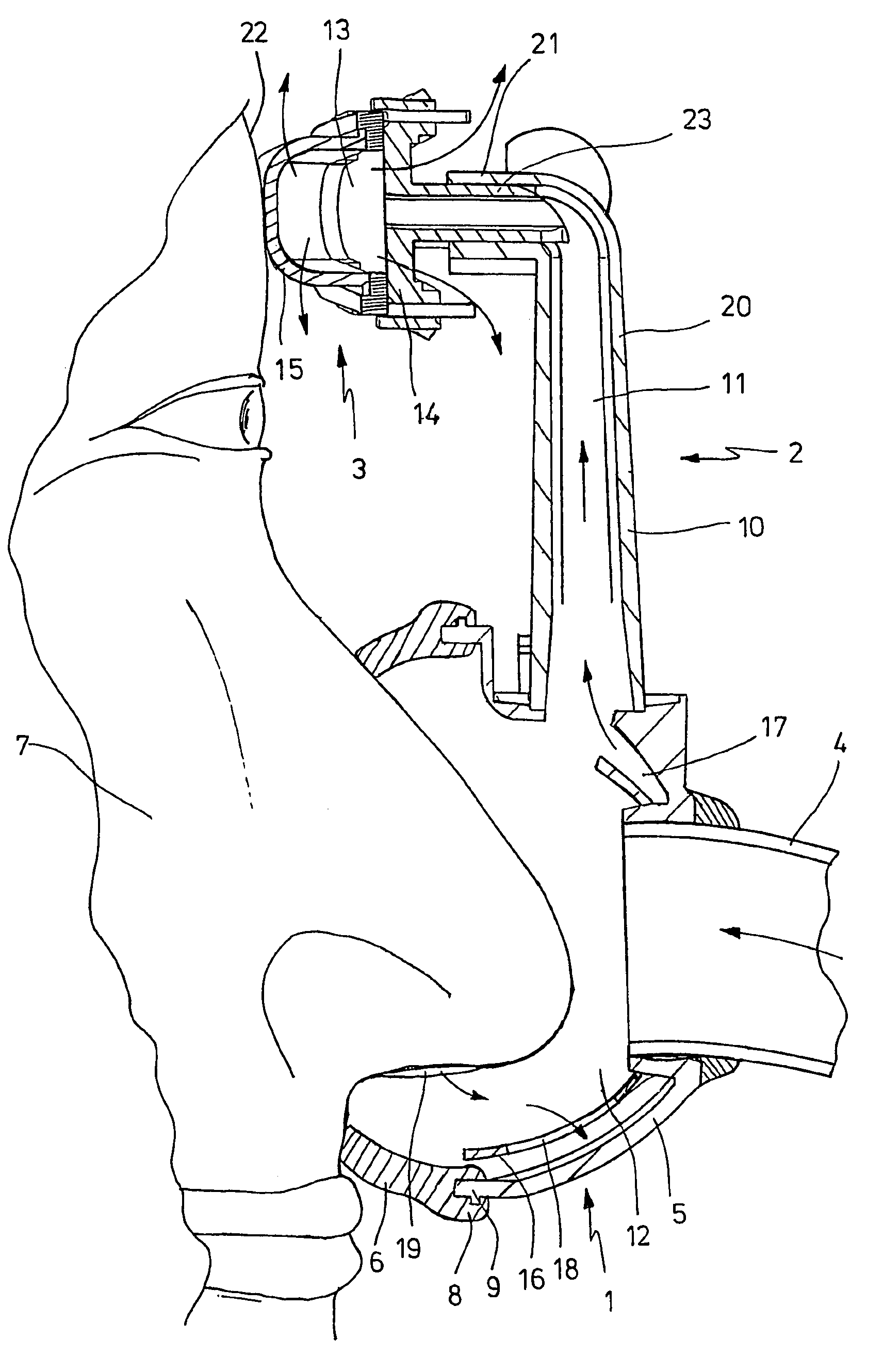 Respiratory device