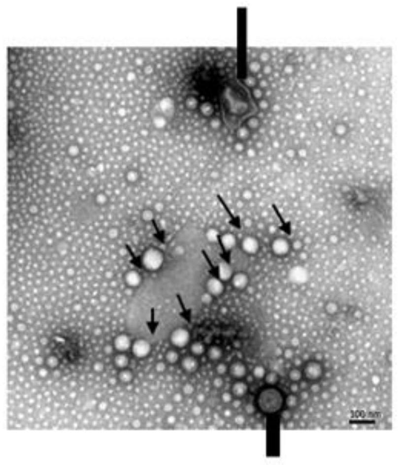 Method for purifying extracellular vesicles