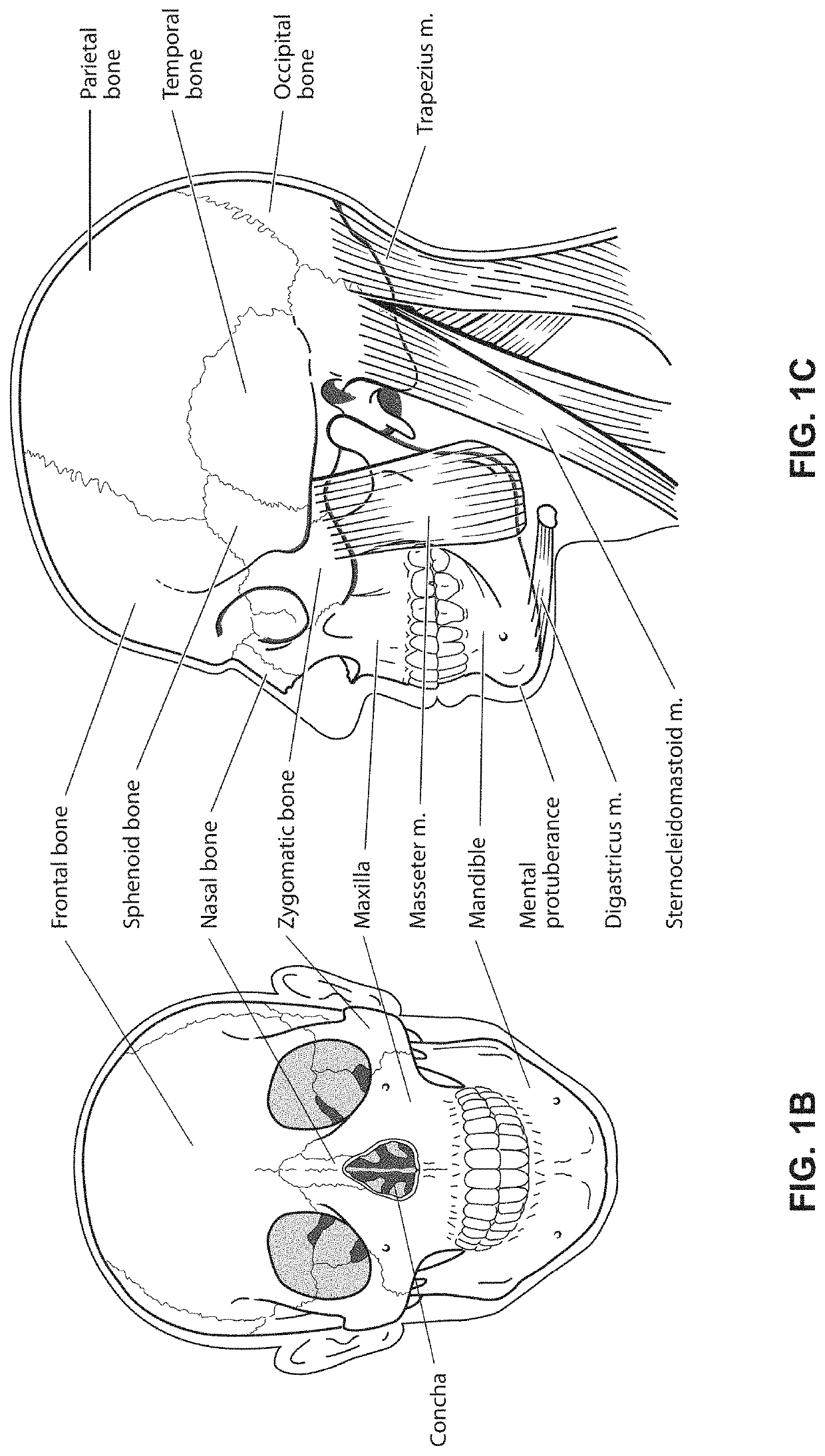 Positioning and stabilising structure and system incorporating same