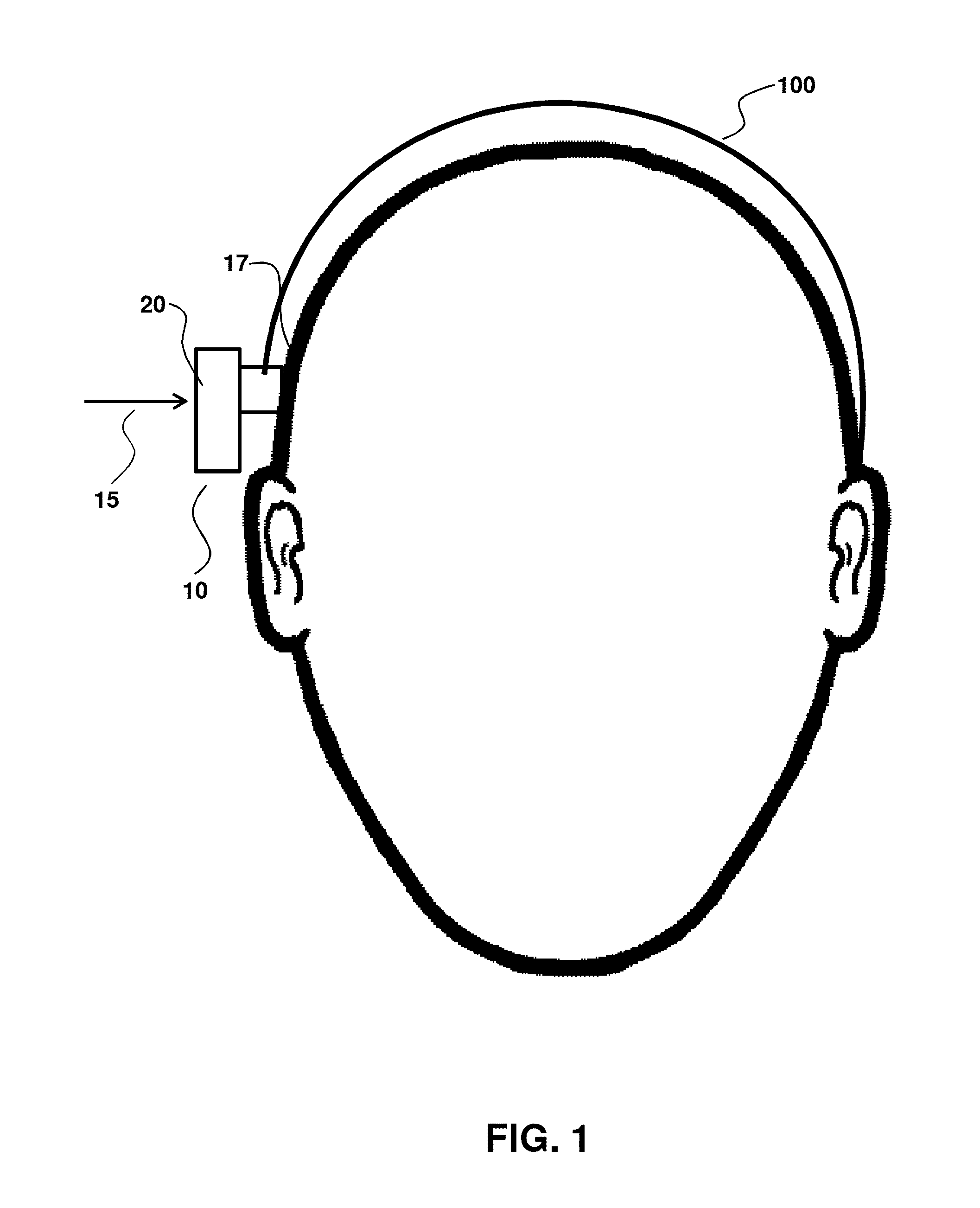 Adhesive Bone Conduction Hearing Device