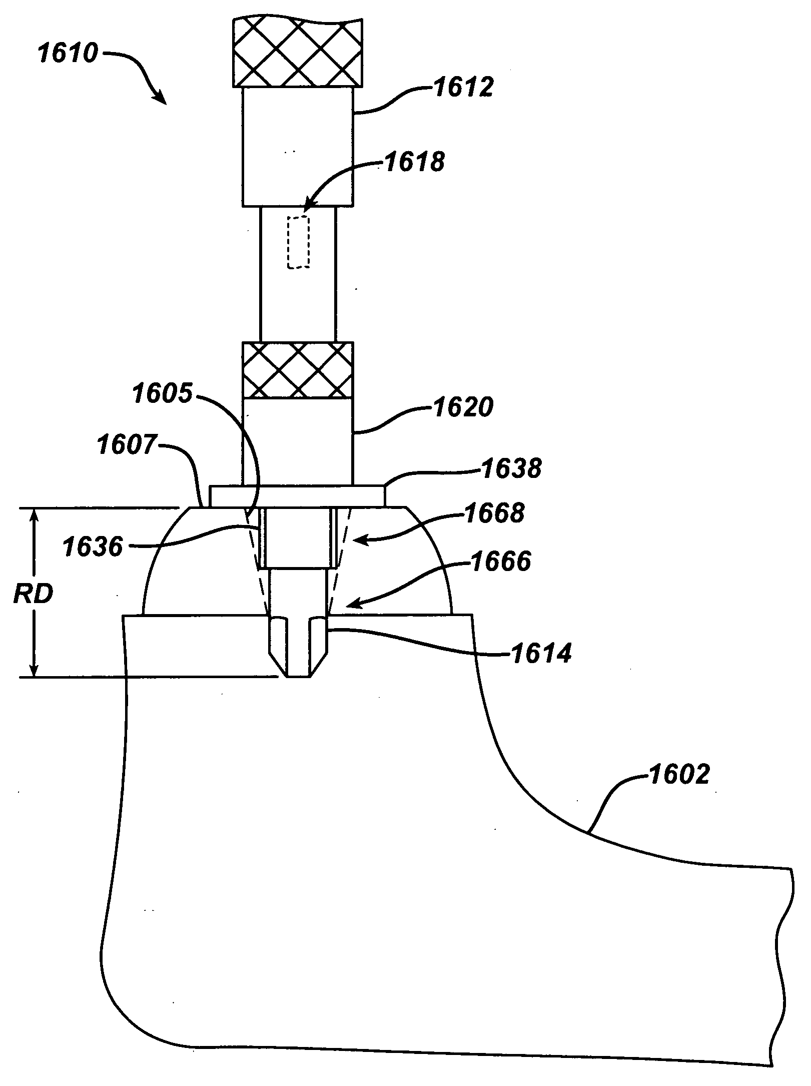 Punch, implant and associated method