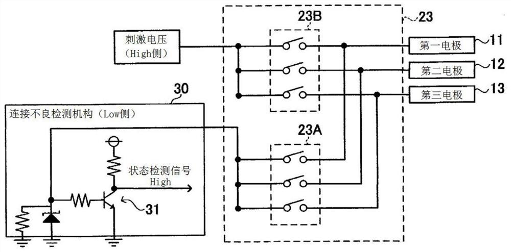 Electrical stimulator