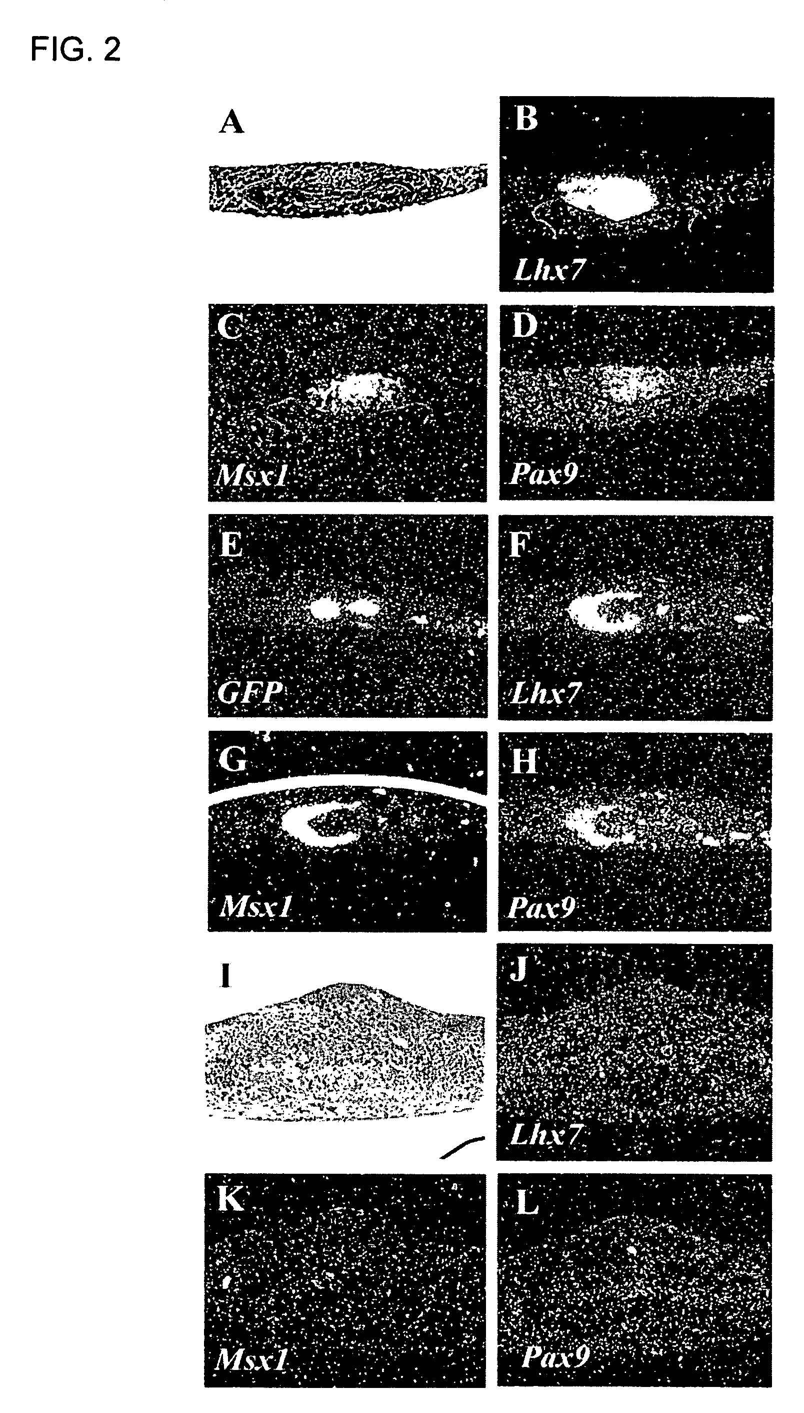 Bone regeneration