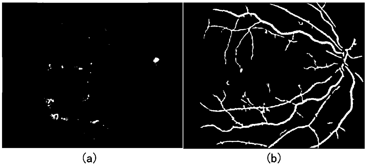 A diabetic retinopathy detection system based on serial structure segmentation