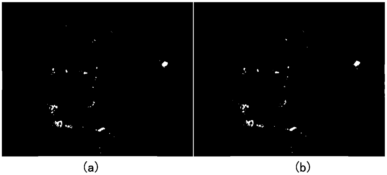 A diabetic retinopathy detection system based on serial structure segmentation