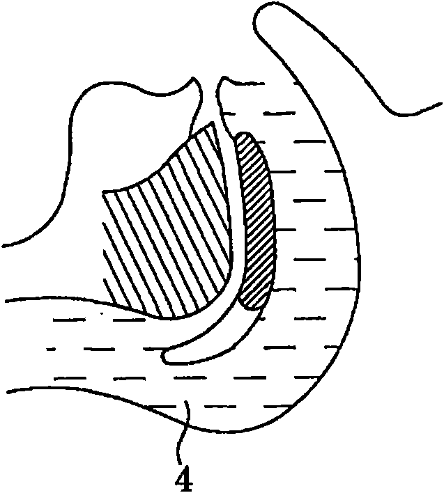 Clothes and method for preventing sleeping respiratory obstruction and/or decubitus