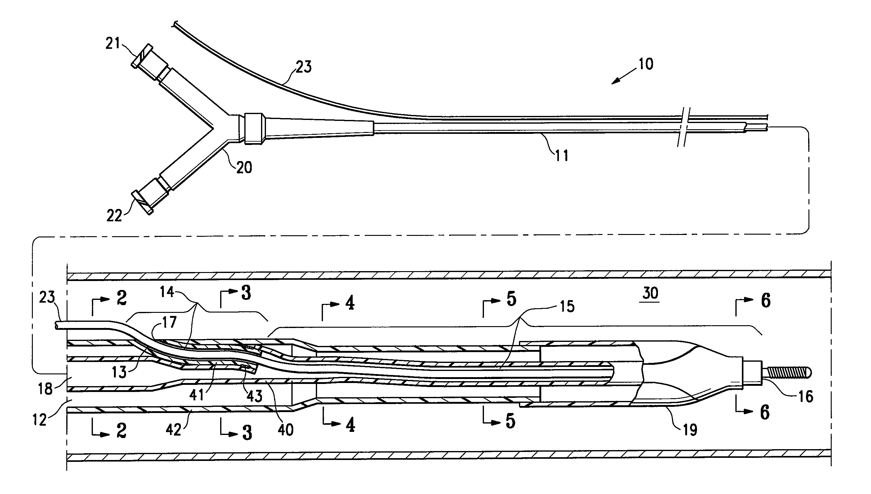 Rapid exchange infusion catheter