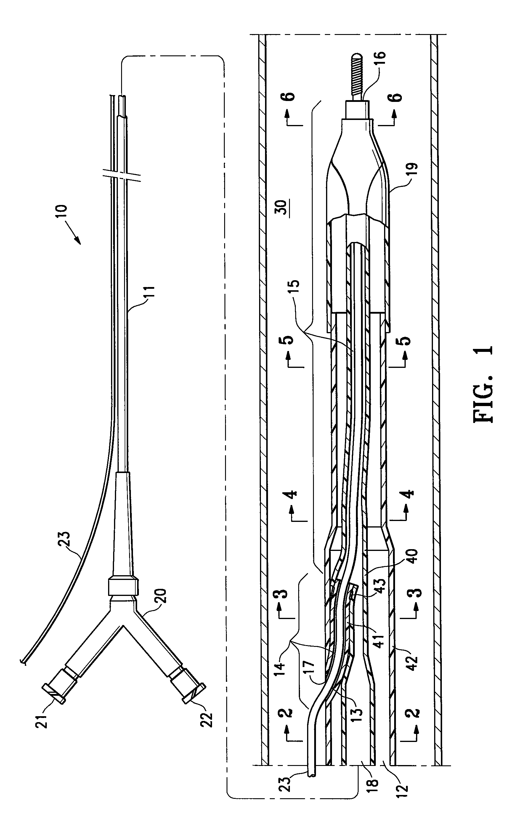 Rapid exchange infusion catheter